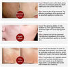 LANBENA - Pore Solution Serum